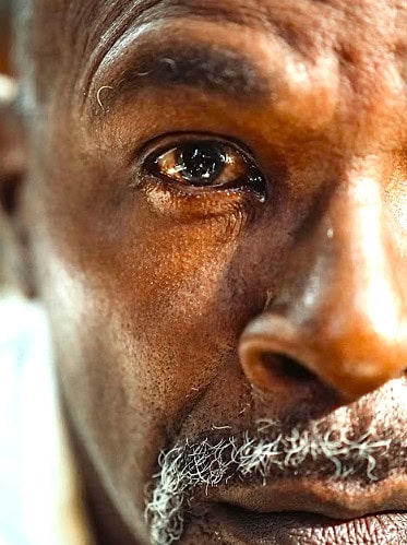 Close-up of an elderly man with teary eyes symbolising Tailored Support Cancer Journey during his cancer struggle.